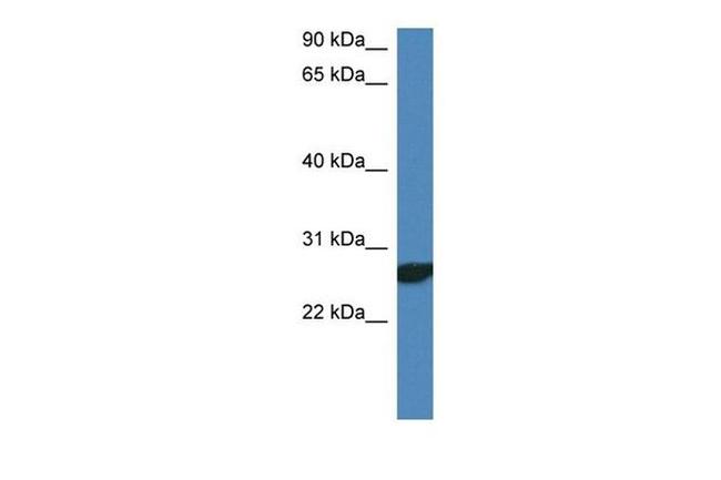 NDFIP2 Antibody in Western Blot (WB)