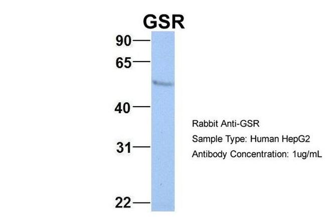 GSR Antibody in Western Blot (WB)