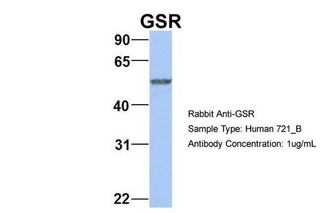 GSR Antibody in Western Blot (WB)