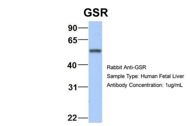 GSR Antibody in Western Blot (WB)