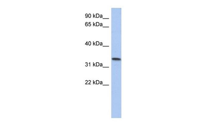 C10orf96 Antibody in Western Blot (WB)