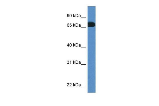 Protein S Antibody in Western Blot (WB)