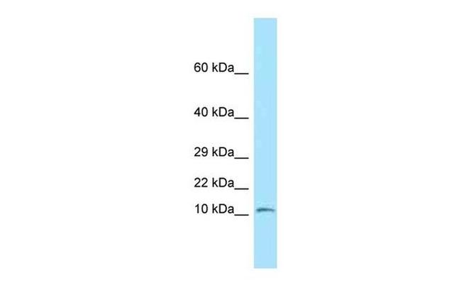 NDUFS6 Antibody in Western Blot (WB)