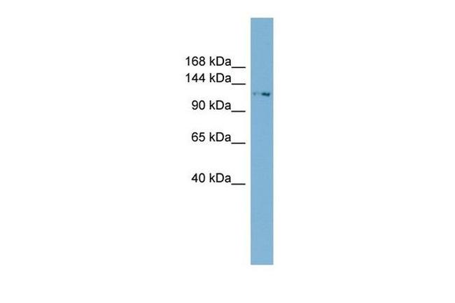 TTC17 Antibody in Western Blot (WB)