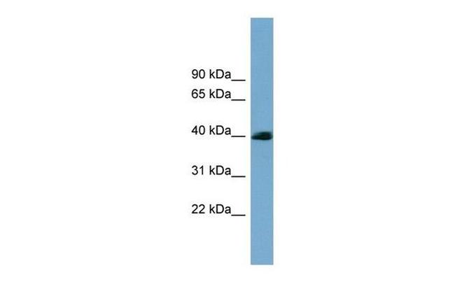 SASH3 Antibody in Western Blot (WB)