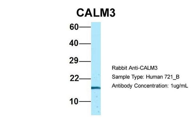 Calmodulin 3 Antibody in Western Blot (WB)