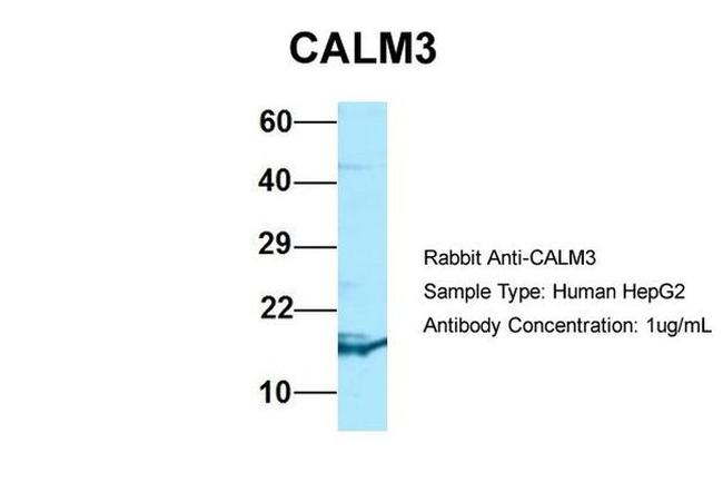 Calmodulin 3 Antibody in Western Blot (WB)