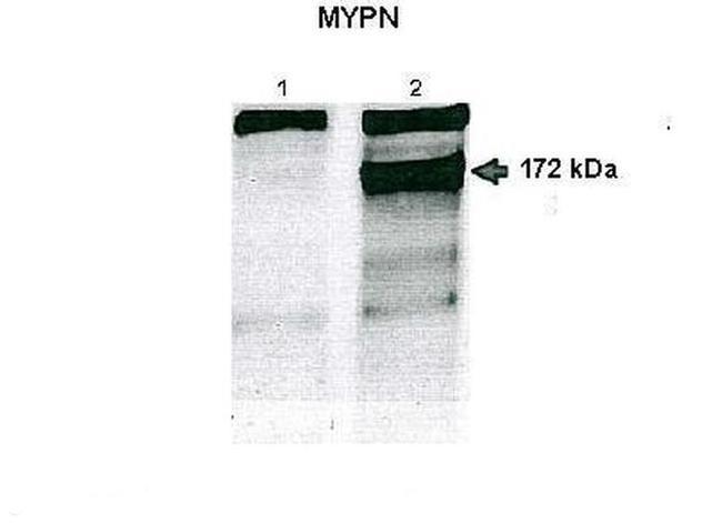 MYPN Antibody in Western Blot (WB)