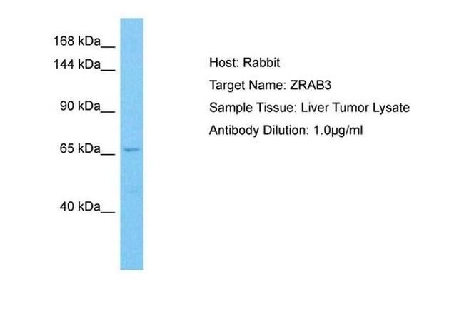 ZRANB3 Antibody in Western Blot (WB)