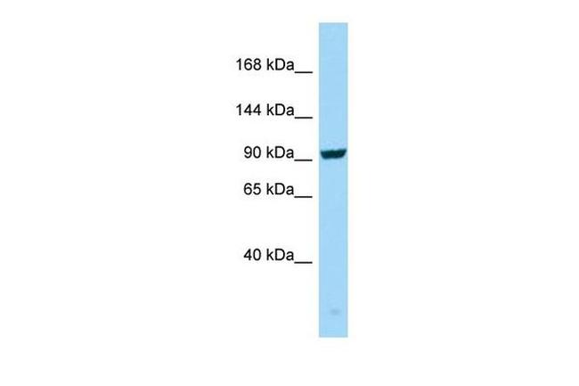 SEZ6 Antibody in Western Blot (WB)