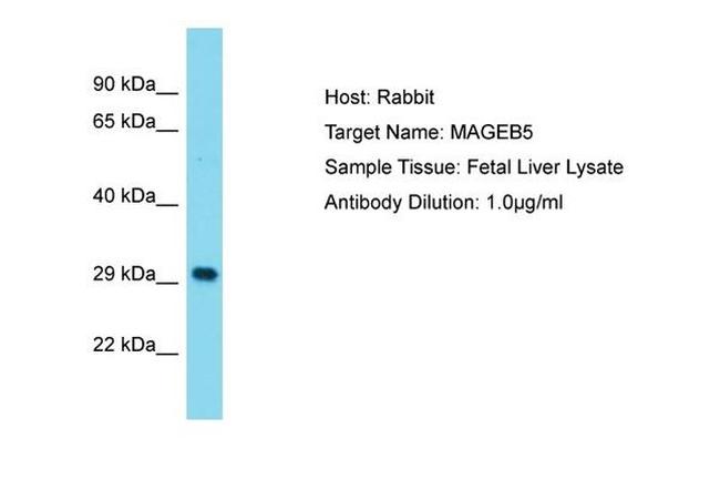 MAGEB5 Antibody in Western Blot (WB)