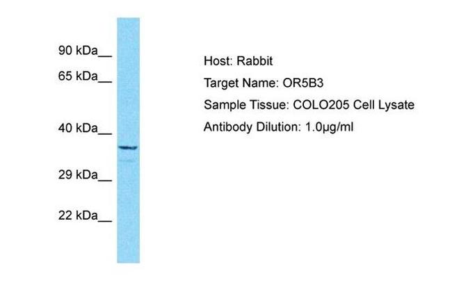 OR5B3 Antibody in Western Blot (WB)