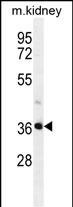 PIH1D2 Antibody in Western Blot (WB)