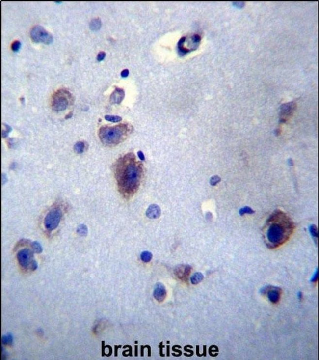 PRLH Antibody in Immunohistochemistry (Paraffin) (IHC (P))