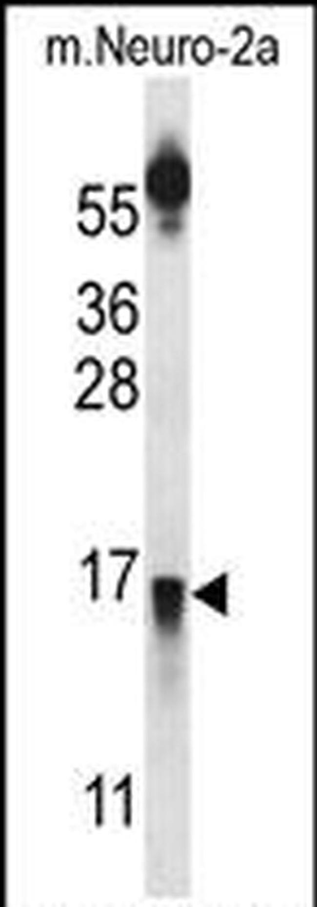 PRLH Antibody in Western Blot (WB)