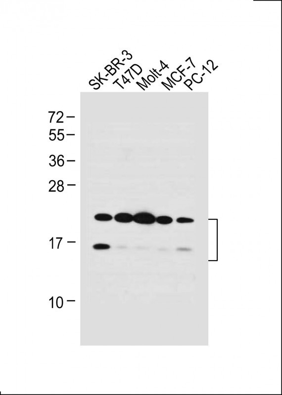 UBE2W Antibody in Western Blot (WB)