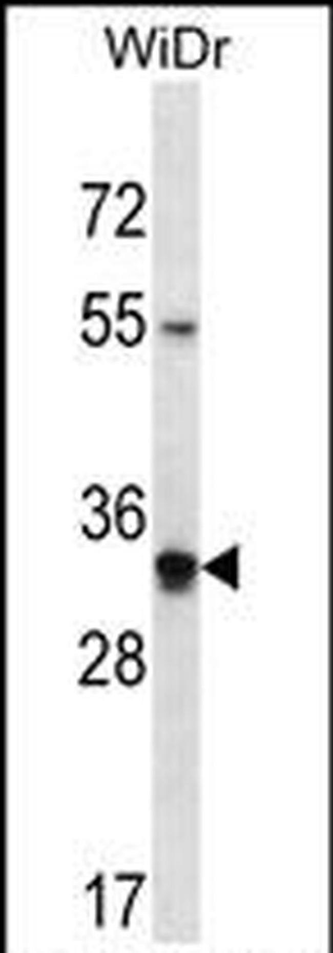 OR2W5 Antibody in Western Blot (WB)