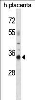 OR4K13 Antibody in Western Blot (WB)