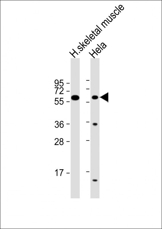 ENT2 Antibody in Western Blot (WB)