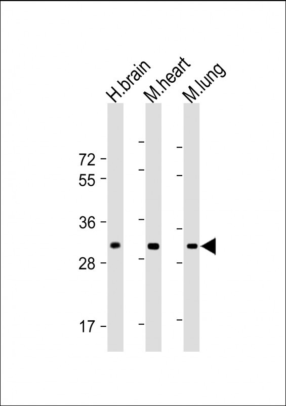 CH25H Antibody in Western Blot (WB)