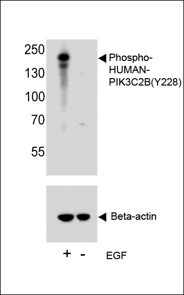 Phospho-PIK3C2B (Tyr228) Antibody in Western Blot (WB)