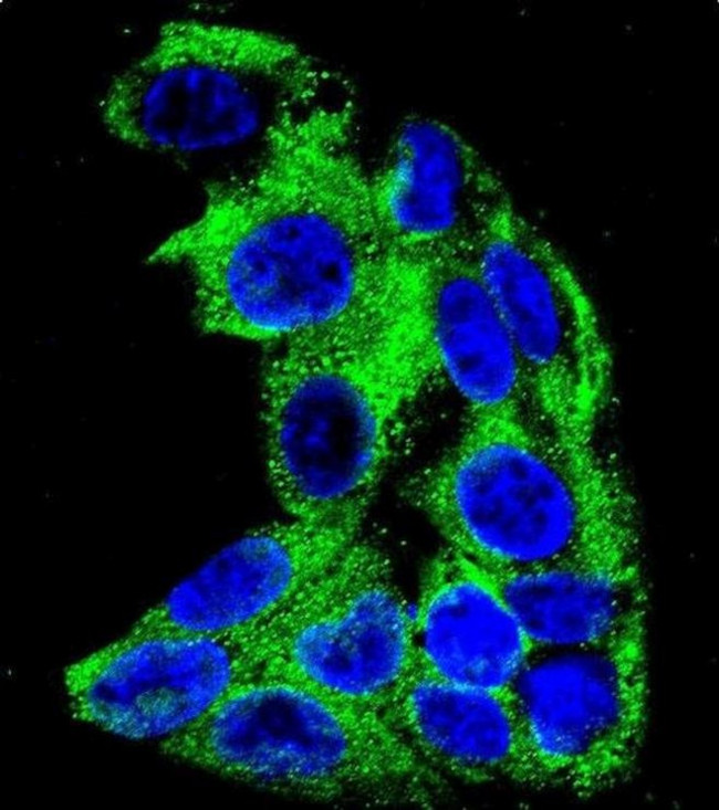 ACADM Antibody in Immunocytochemistry (ICC/IF)