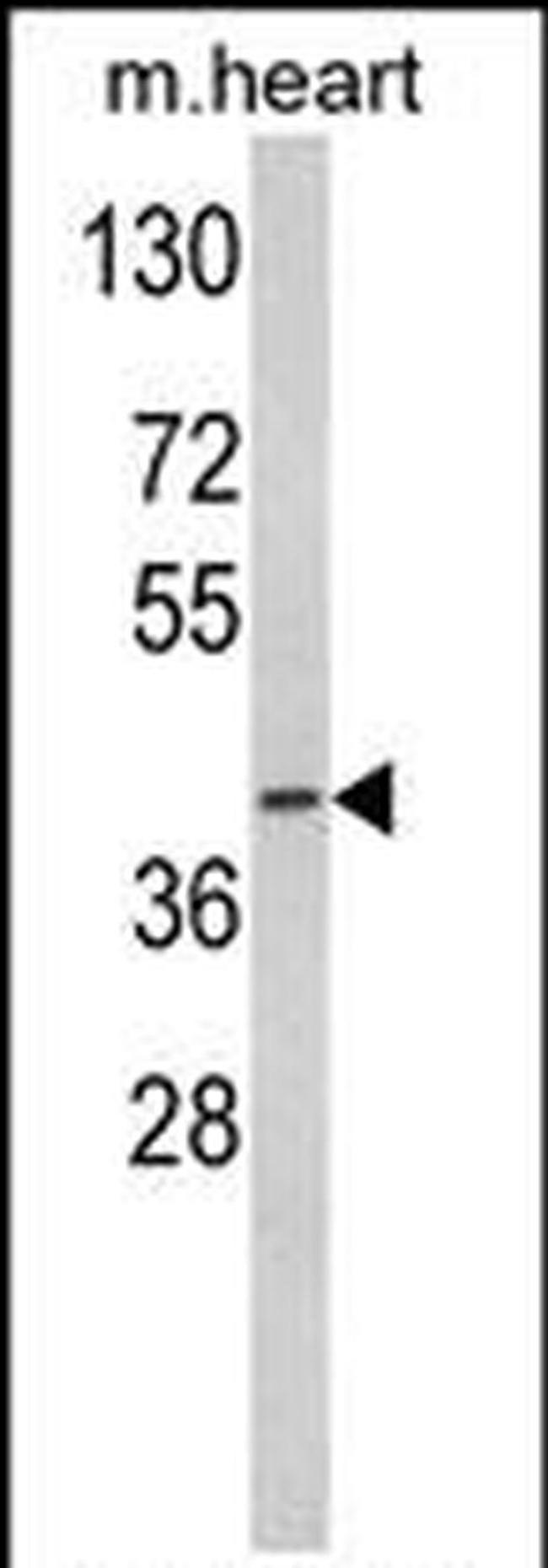 ACADM Antibody in Western Blot (WB)