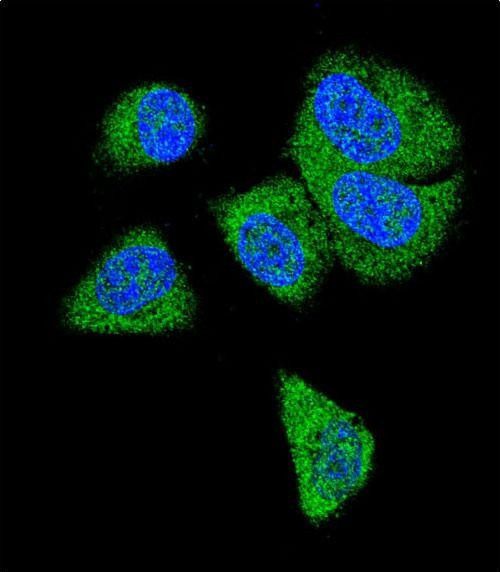 Complement C6 Antibody in Immunocytochemistry (ICC/IF)