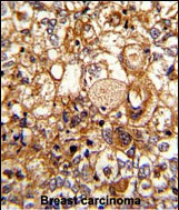 Complement C6 Antibody in Immunohistochemistry (Paraffin) (IHC (P))