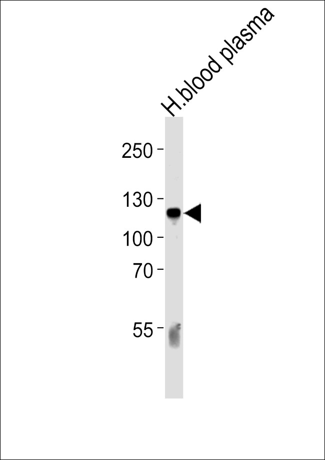 Complement C6 Antibody in Western Blot (WB)