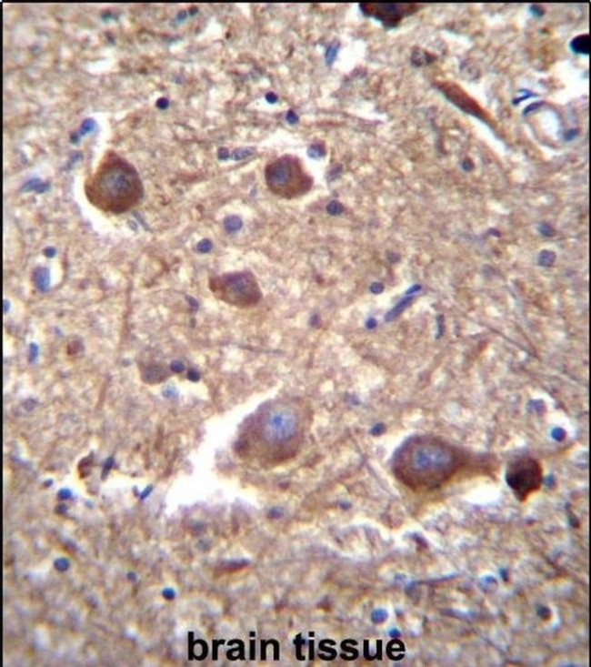 ITPKB Antibody in Immunohistochemistry (IHC)