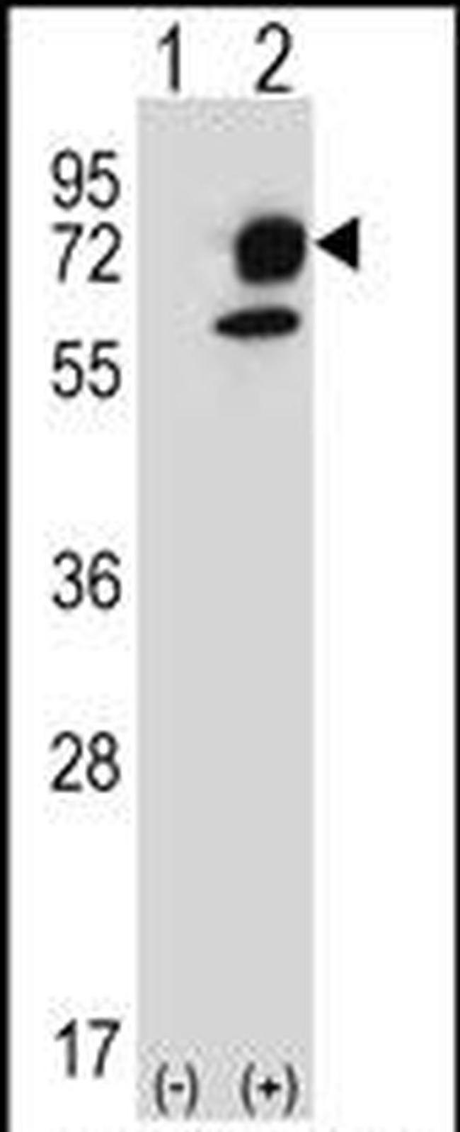 ITPKB Antibody in Western Blot (WB)