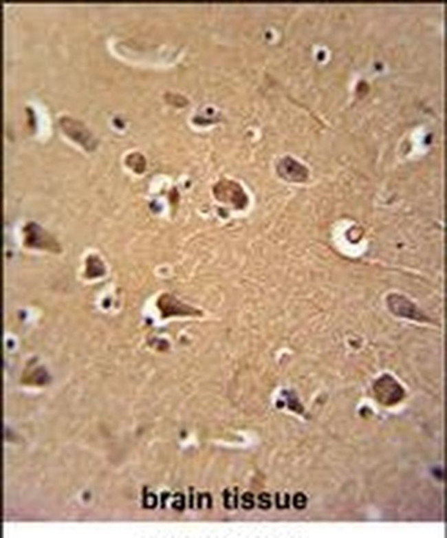 Calmodulin 1 Antibody in Immunohistochemistry (IHC)