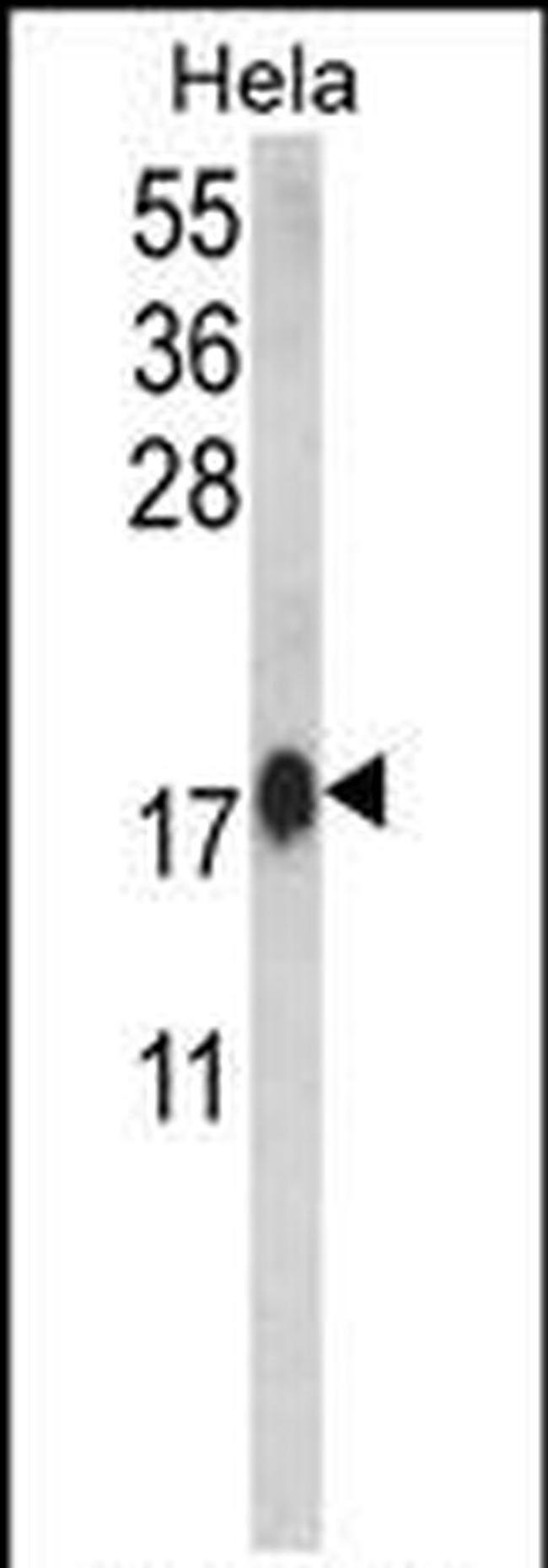 Calmodulin 1 Antibody in Western Blot (WB)