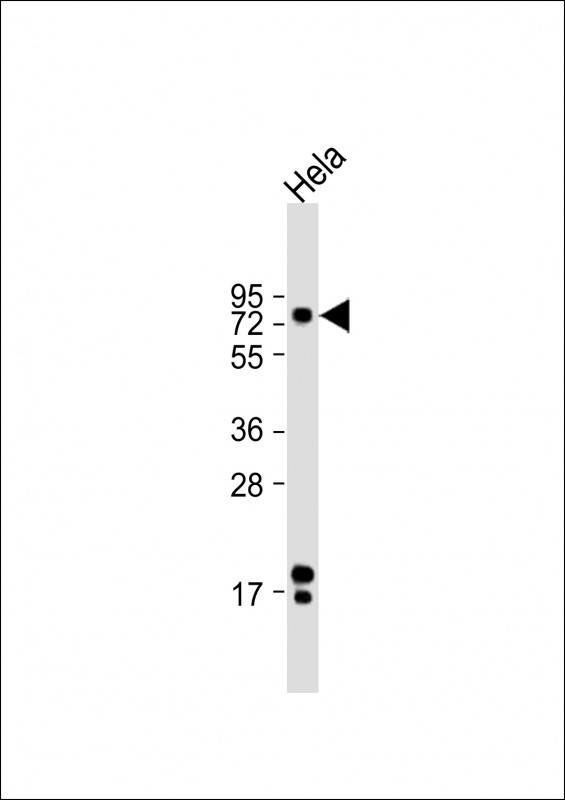 ATF6 Antibody in Western Blot (WB)