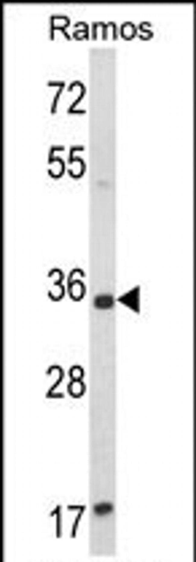 ACY3 Antibody in Western Blot (WB)