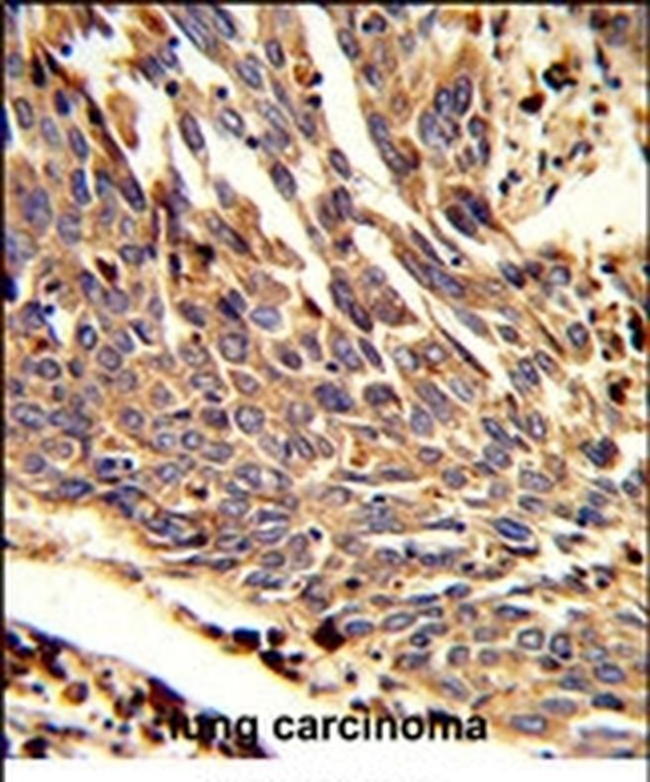 p41-ARCb Antibody in Immunohistochemistry (IHC)