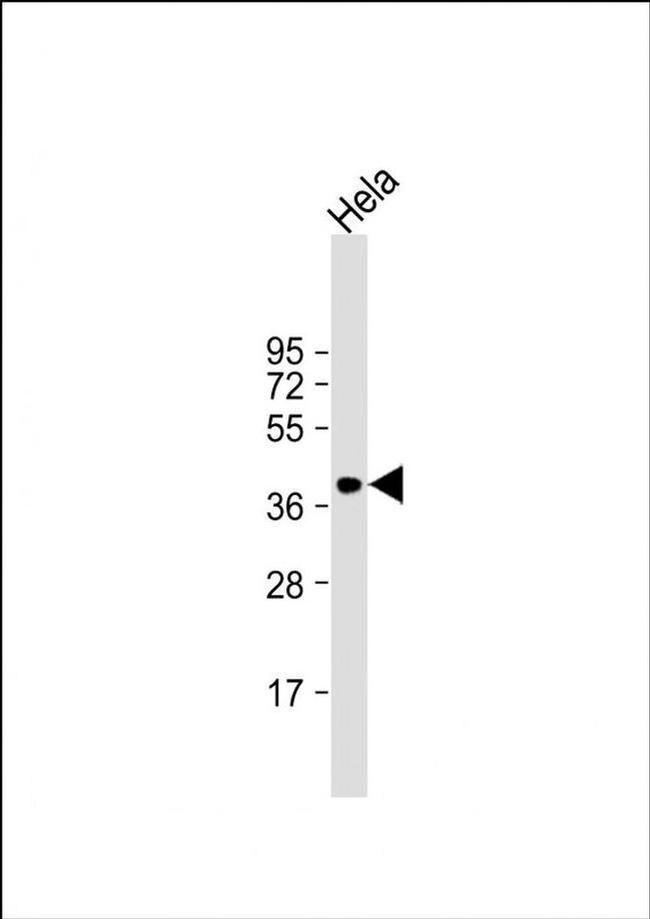 p41-ARCb Antibody in Western Blot (WB)