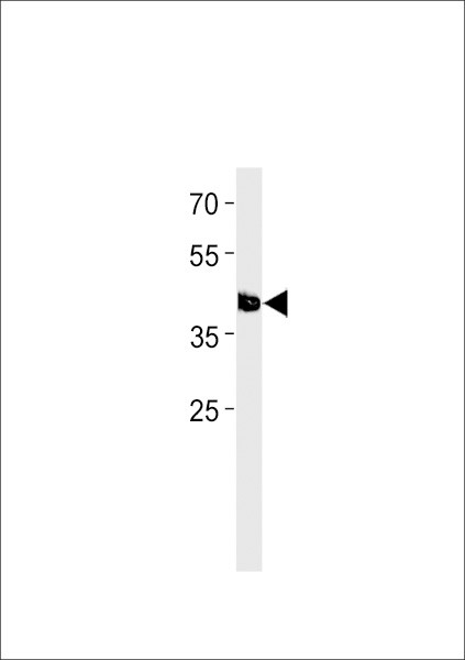 TFAP2E Antibody in Western Blot (WB)