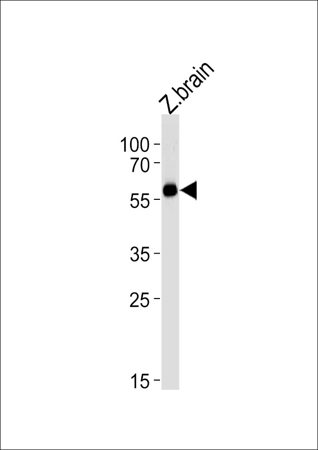 FOXH1 Antibody in Western Blot (WB)