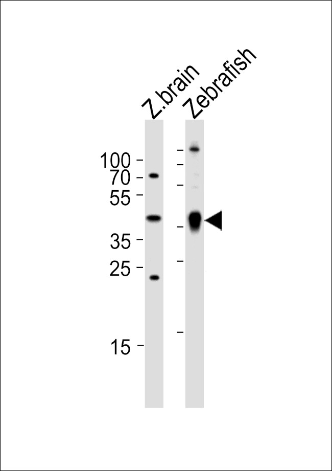 Adenosine Deaminase Antibody in Western Blot (WB)