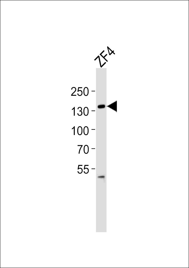 PKN2 Antibody in Western Blot (WB)