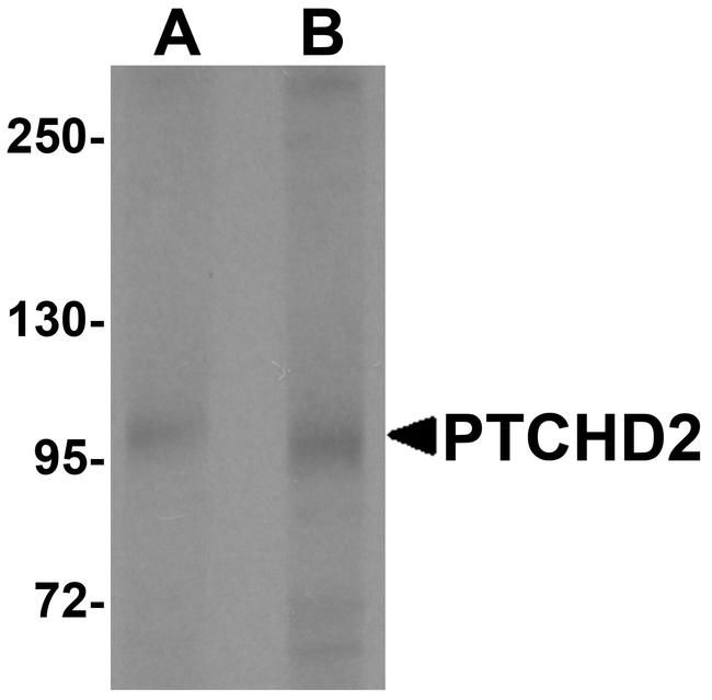 PTCHD2 Antibody in Western Blot (WB)