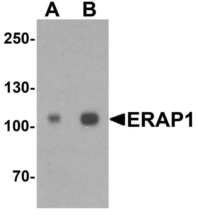 ARTS1 Antibody in Western Blot (WB)