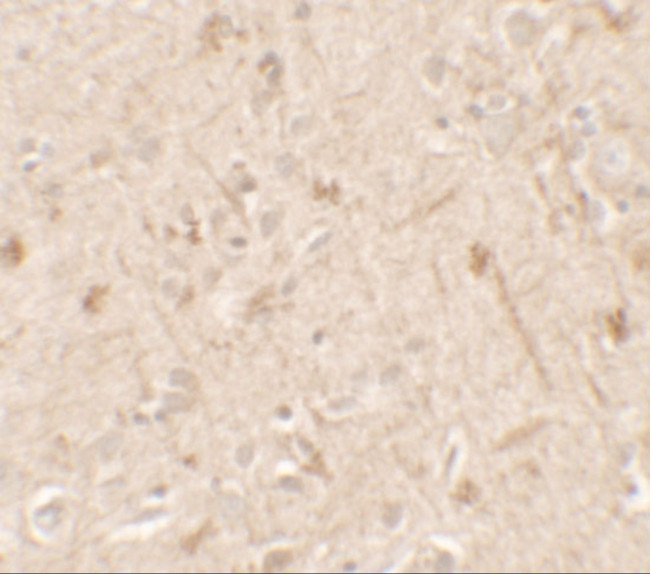 IL1F6 Antibody in Immunohistochemistry (Paraffin) (IHC (P))