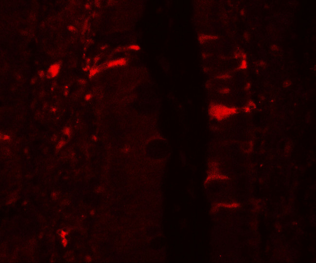 IL1F5 Antibody in Immunohistochemistry (Paraffin) (IHC (P))