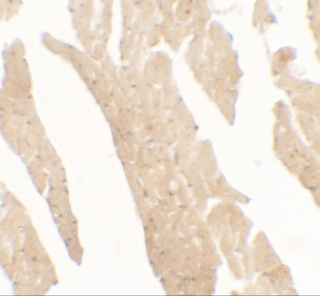 IL1F5 Antibody in Immunohistochemistry (Paraffin) (IHC (P))