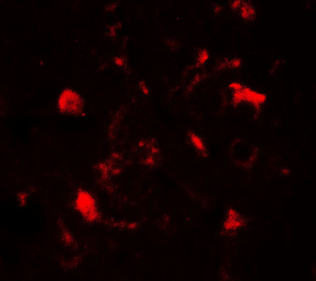 TET1 Antibody in Immunohistochemistry (Paraffin) (IHC (P))