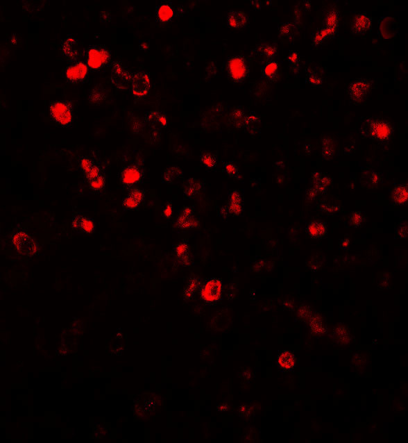 NOX4 Antibody in Immunohistochemistry (Paraffin) (IHC (P))