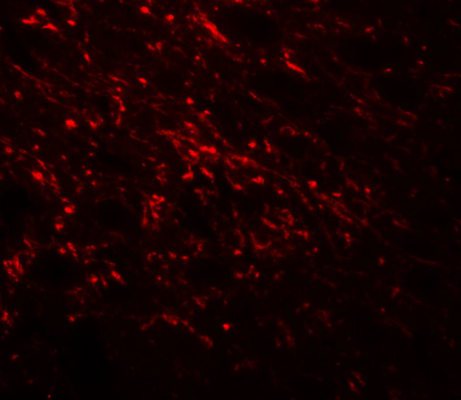 NAP1L5 Antibody in Immunohistochemistry (Paraffin) (IHC (P))